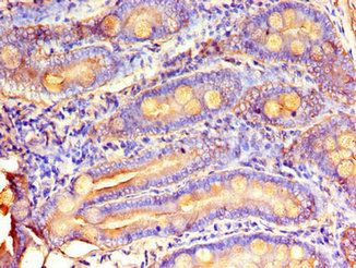 MTTP antibody