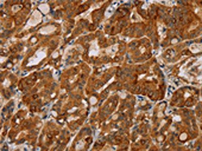 MTUS1 Antibody