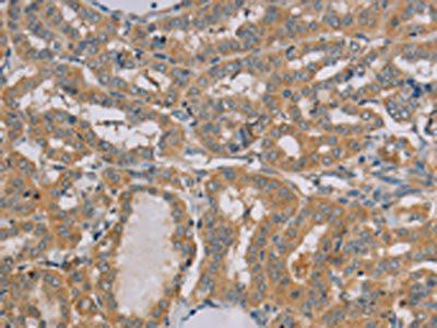 MTUS1 Antibody