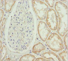 MTX2 Antibody