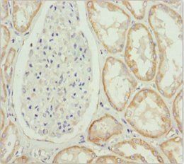 MTX2 antibody