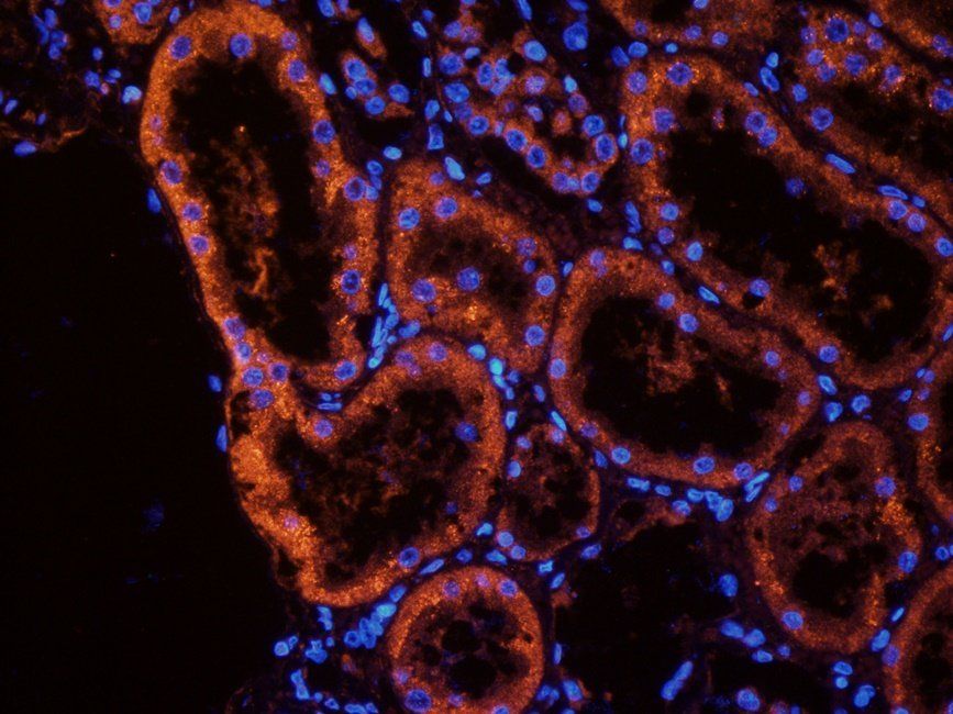 MUC1 antibody