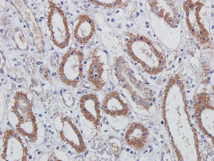 MUC1 antibody