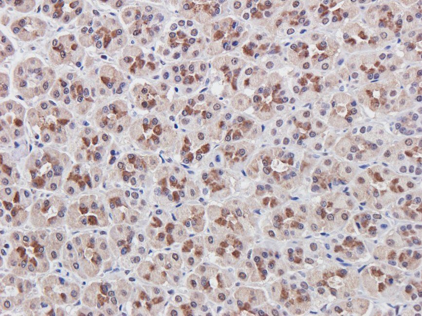 MUC1 antibody