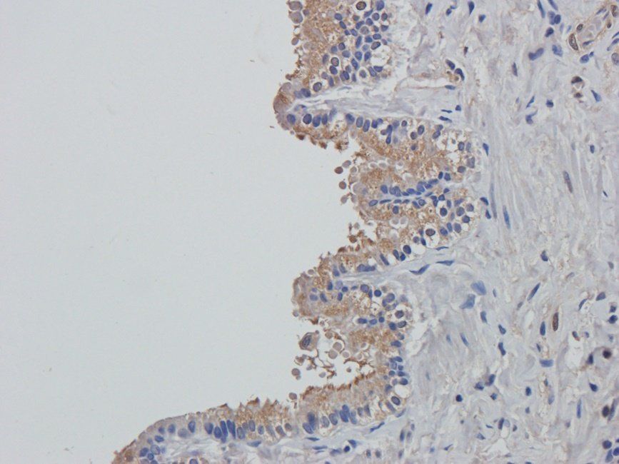 MUC1 antibody