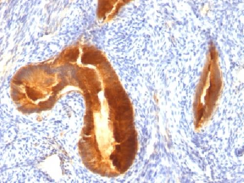 MUC1 / CA15-3 / EMA / CD227 (Epithelial Marker) Antibody