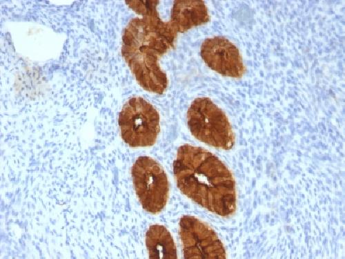 MUC1 / CA15-3 / EMA / CD227 (Epithelial Marker) Antibody