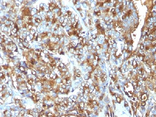 MUC1 / CA15-3 / EMA / CD227 (Epithelial Marker) Antibody