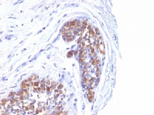 MUC1 / CA15-3 / EMA / CD227 (Epithelial Marker) Antibody