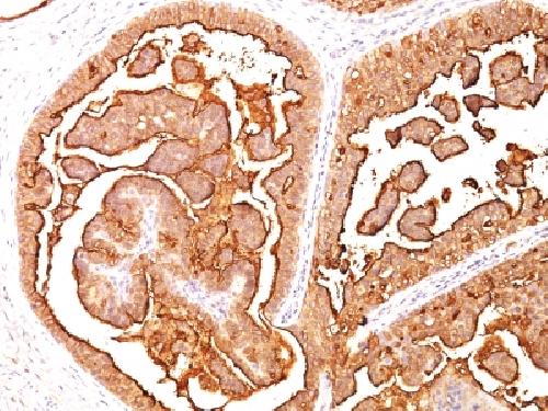 MUC1 / CA15-3 / EMA / CD227 (Epithelial Marker) Antibody