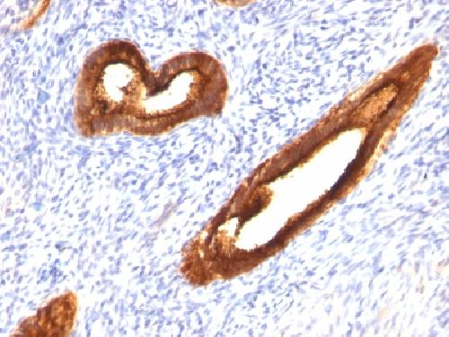 MUC1 / CA15-3 / EMA / CD227 (Epithelial Marker) Antibody