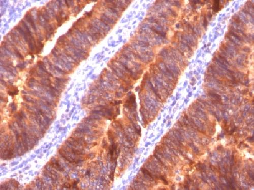 MUC1 / CA15-3 / EMA / CD227 (Epithelial Marker) Antibody