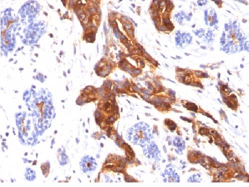 MUC1 / CA15-3 / EMA / CD227 (Epithelial Marker) Antibody