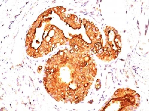 MUC1 / CA15-3 / EMA / CD227 (Epithelial Marker) Antibody