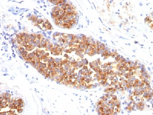 MUC1 / CA15-3 / EMA / CD227 (Epithelial Marker) Antibody