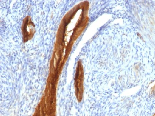 MUC1 antibody