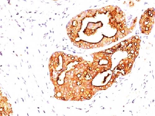 MUC1 antibody