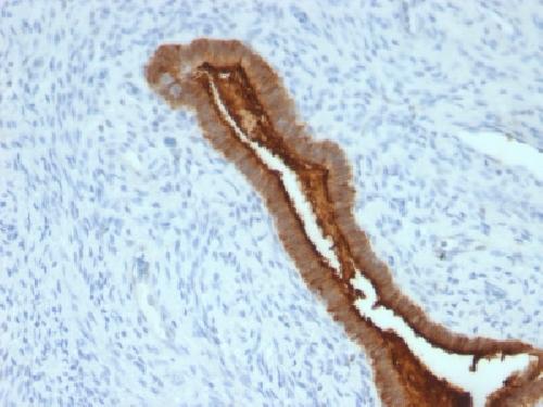 MUC1 Antibody