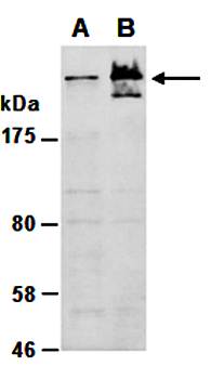 MUC1 (N) Antibody, Rabbit Polyclonal