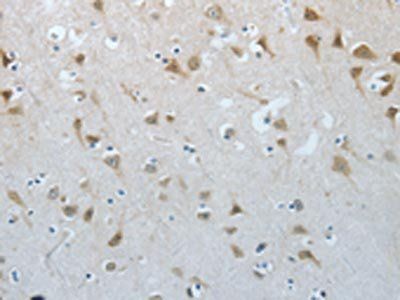 MUC20 antibody