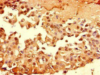 MUC1 Antibody