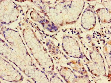 MUC1 Antibody