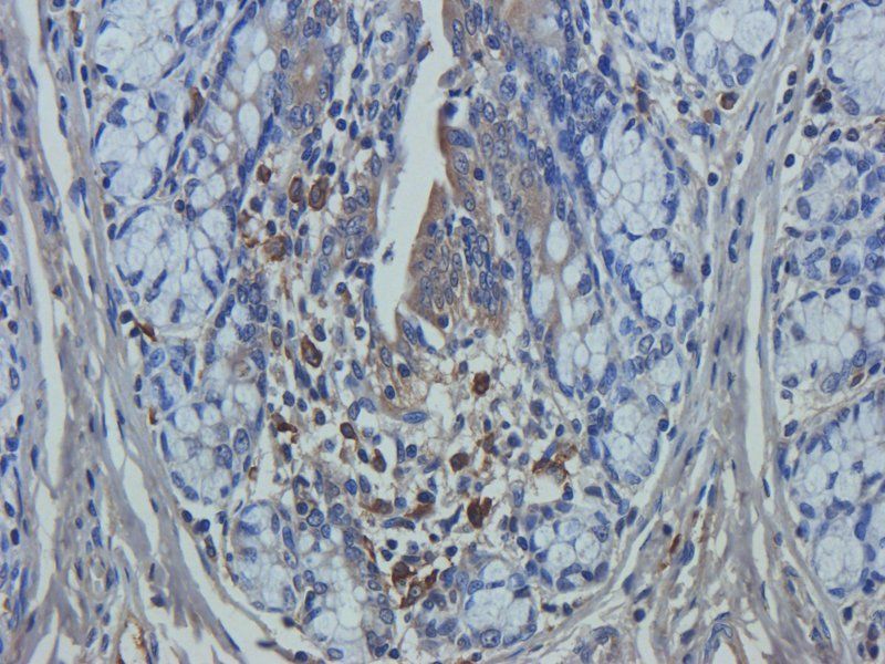 Mucin 5AC antibody