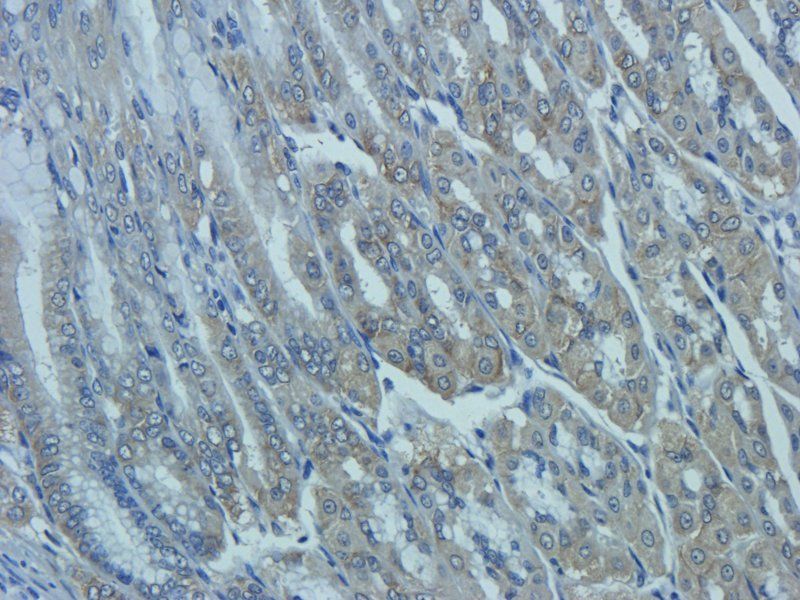 Mucin 5AC antibody