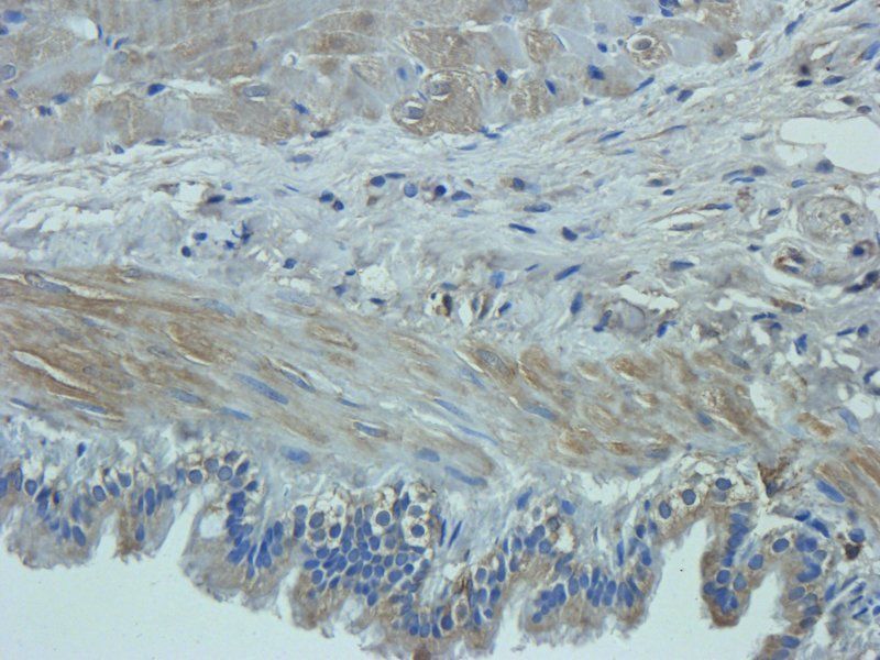 Mucin 5AC antibody