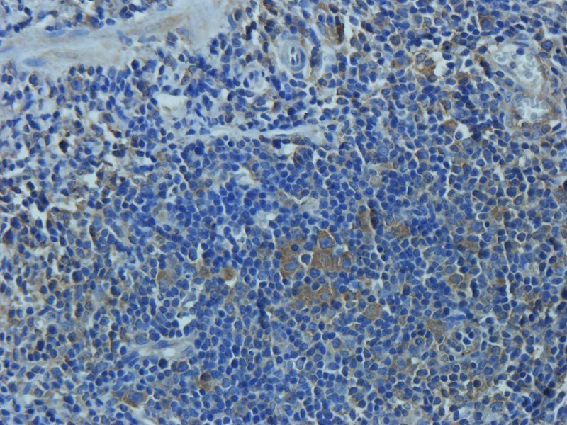 Mucin 5AC antibody