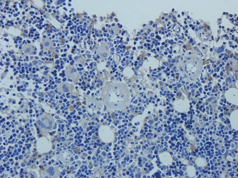 Mucin 5AC antibody