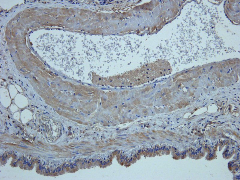 Mucin 5AC antibody