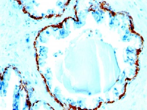 KRT1 Antibody