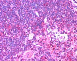 Goat anti-Munc13-4 / UNC13D (Internal) Antibody