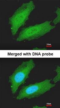 MURF1 antibody