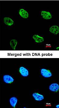 MUS81 antibody