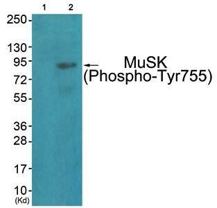 MuSK (phospho-Tyr755) antibody