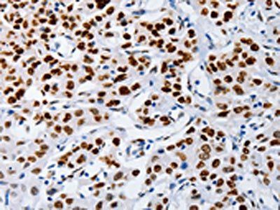 MUTYH Antibody