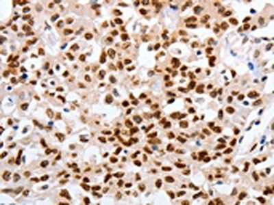 MUTYH Antibody