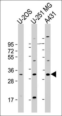 MVB12A antibody