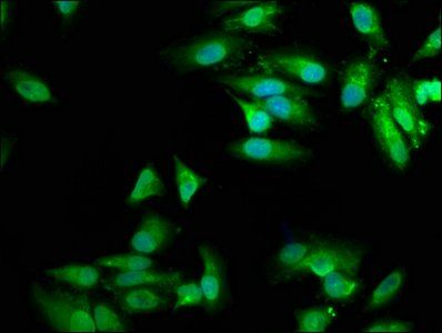 MVD Antibody