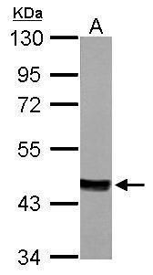 mevalonate diphosphate decarboxylase Antibody