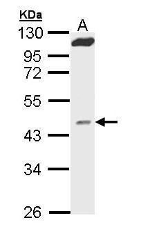 MVD antibody [N1C1]
