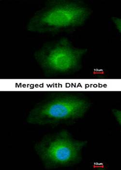MVD antibody
