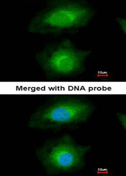 MVD antibody