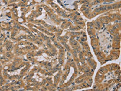 MVK Antibody
