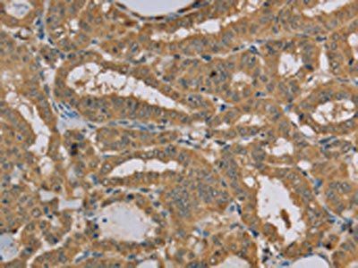 MVK Antibody