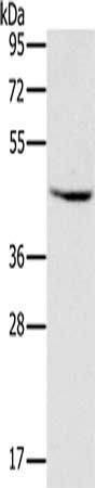 MVK antibody