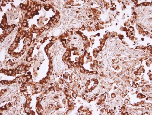 MVP/LRP antibody