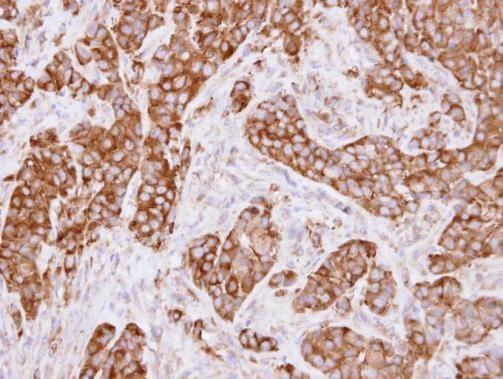 MVP/LRP antibody